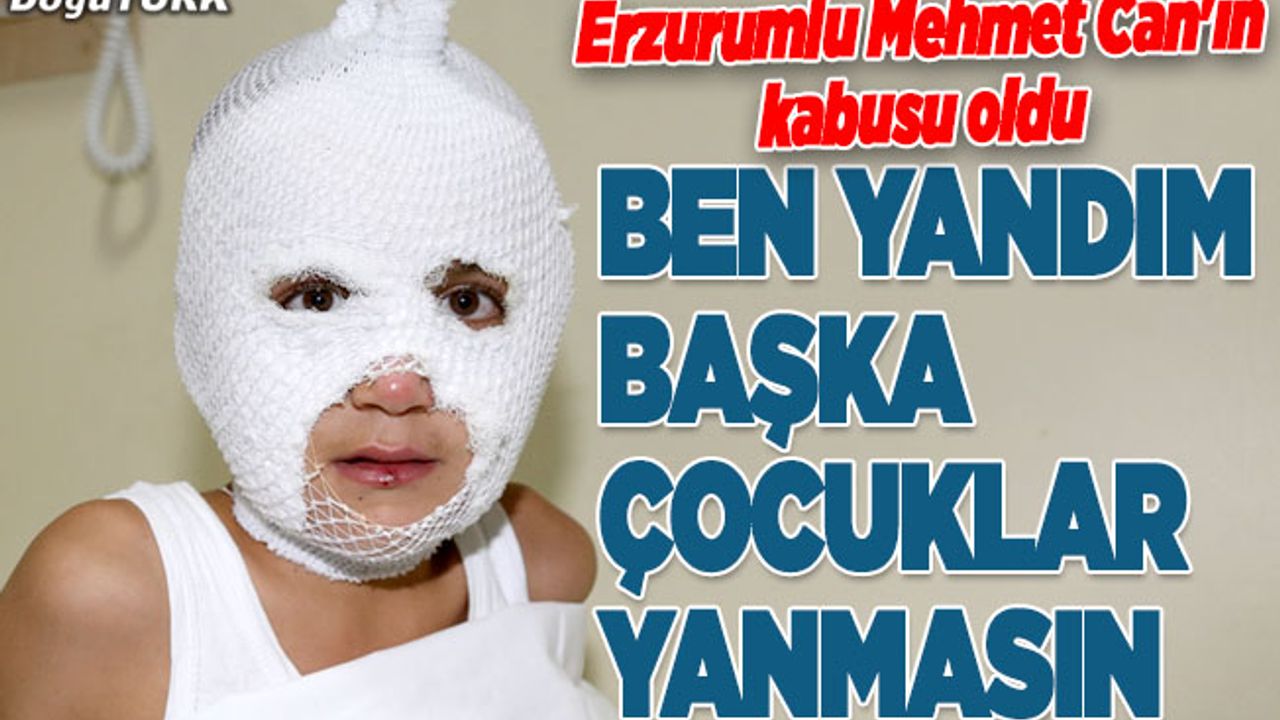 Ateşle oyun Erzurumlu Mehmet Can'ın kâbusu oldu