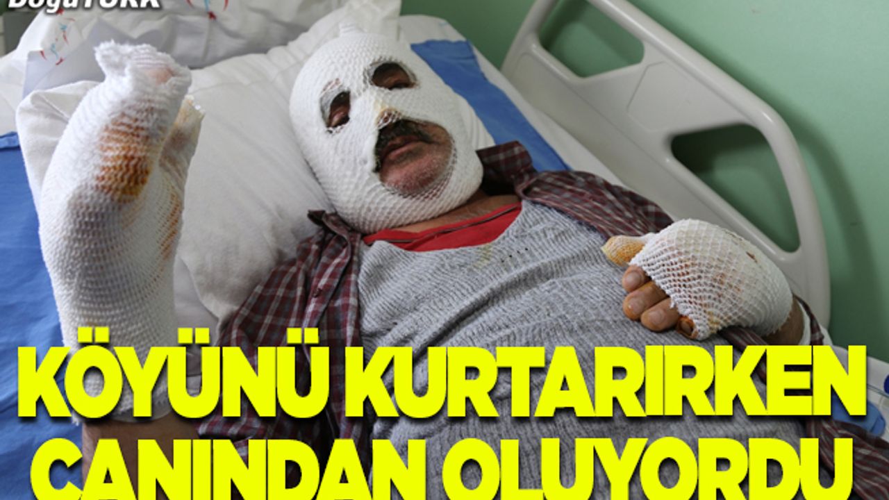 "Köyü yangından kurtarayım" derken canından oluyordu