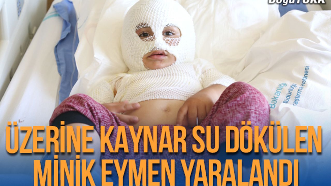 Üzerine kaynar su dökülen Eymen yaralandı!