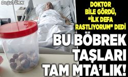 Bu böbrek taşları tam MTA’lık!