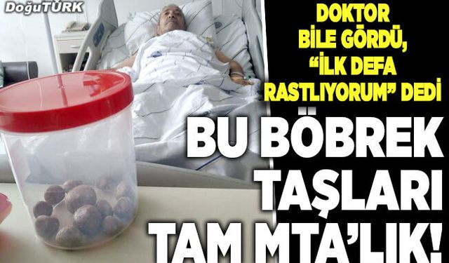 Bu böbrek taşları tam MTA’lık!